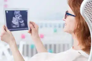 Woman looking happily of ultrasound of baby